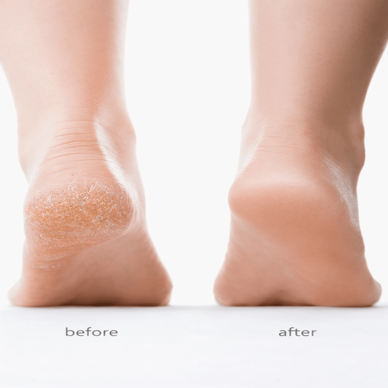 SilkStep™ Electric Foot Buffer - The Beauty Up