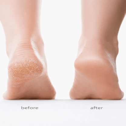 SilkStep™ Electric Foot Buffer - The Beauty Up