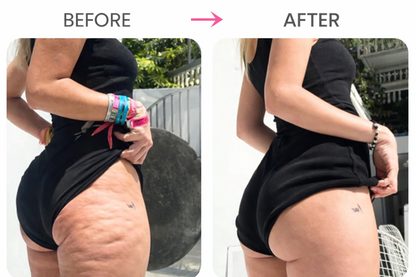 CelluSculpt Pro™ Massager