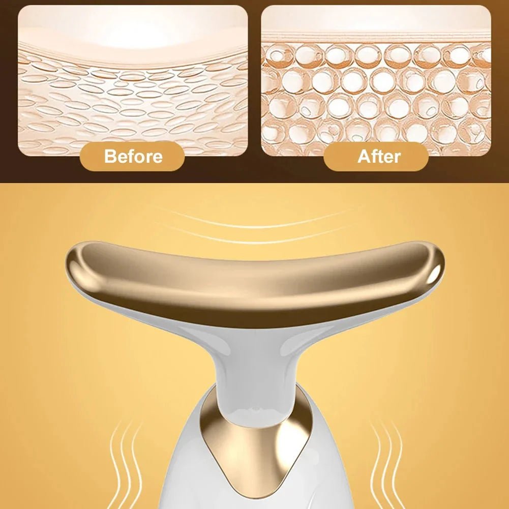 Dolphin Facial Lifter - The Beauty Up